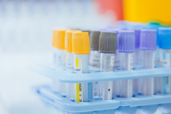 Lire la suite à propos de l’article Professionnels de santé : du nouveau pour les examens biologiques